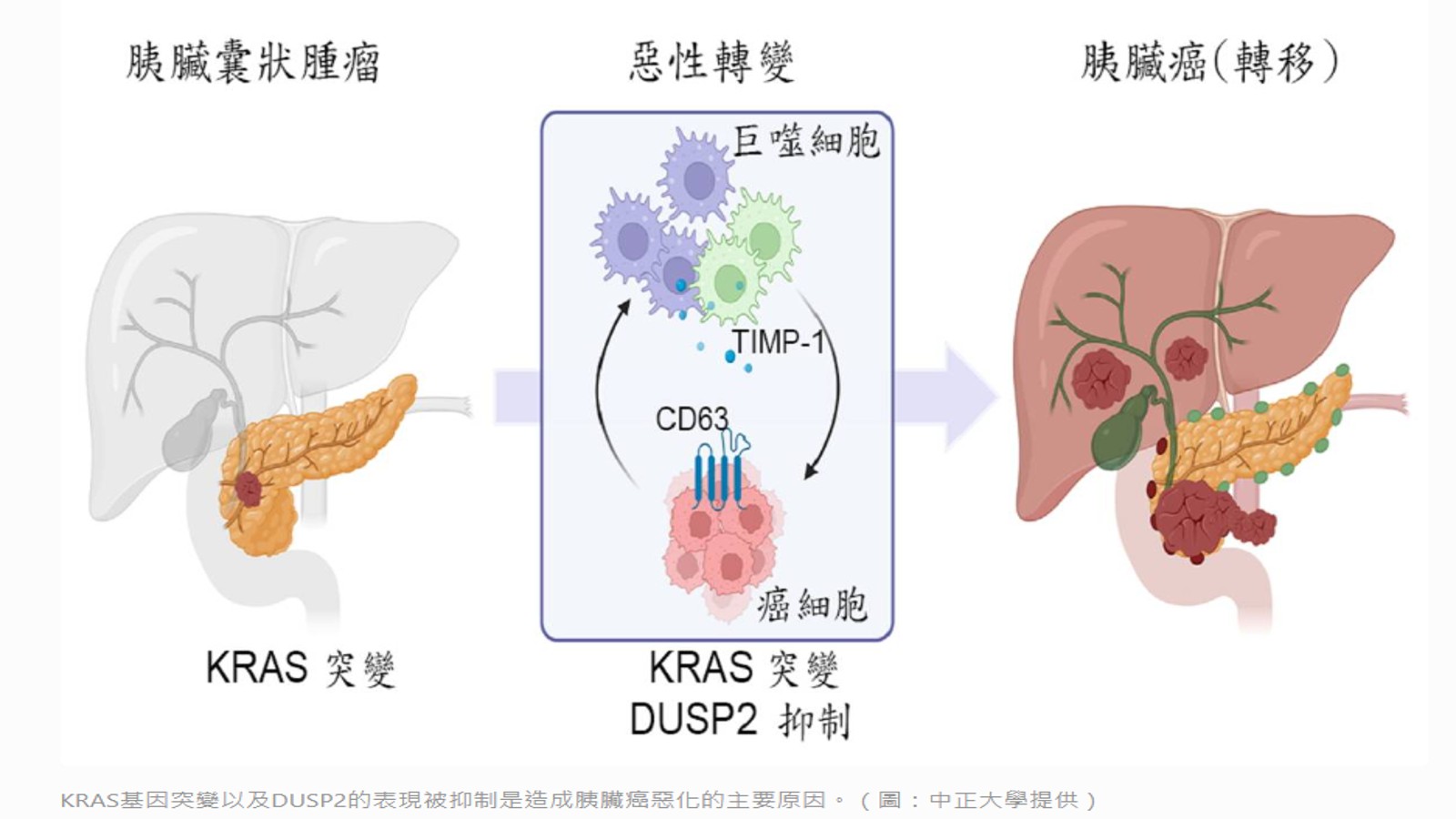 成大、中正聯手!解開胰臟癌細胞惡化及免疫特權的機制